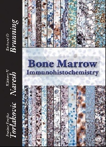 Torlakovic, Emina Emilia, Naresh, Kikkeri N), Brun Bone Marrow Immunohistochemistry 