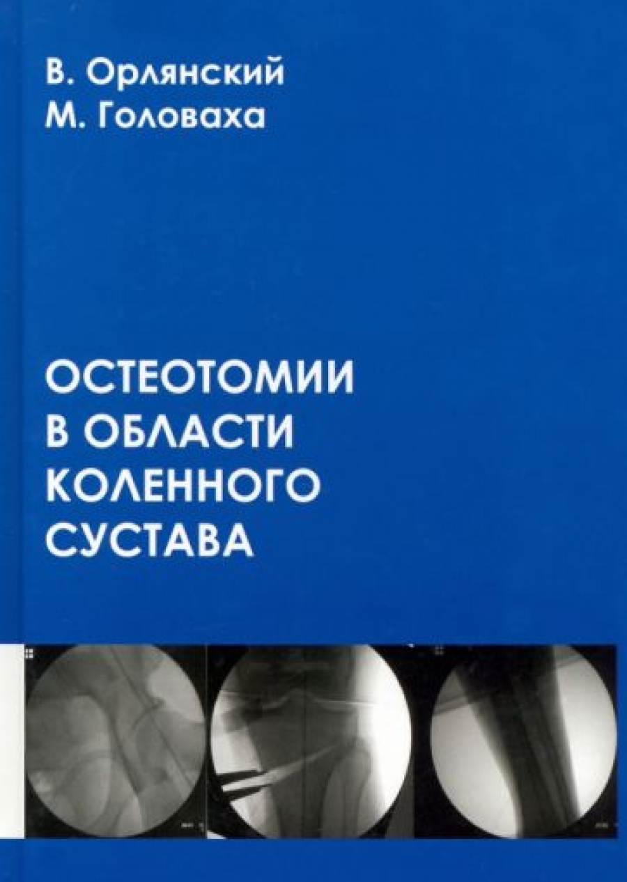 Орлянский В., Головаха М.Л. - Остеотомии в области коленного сустава 