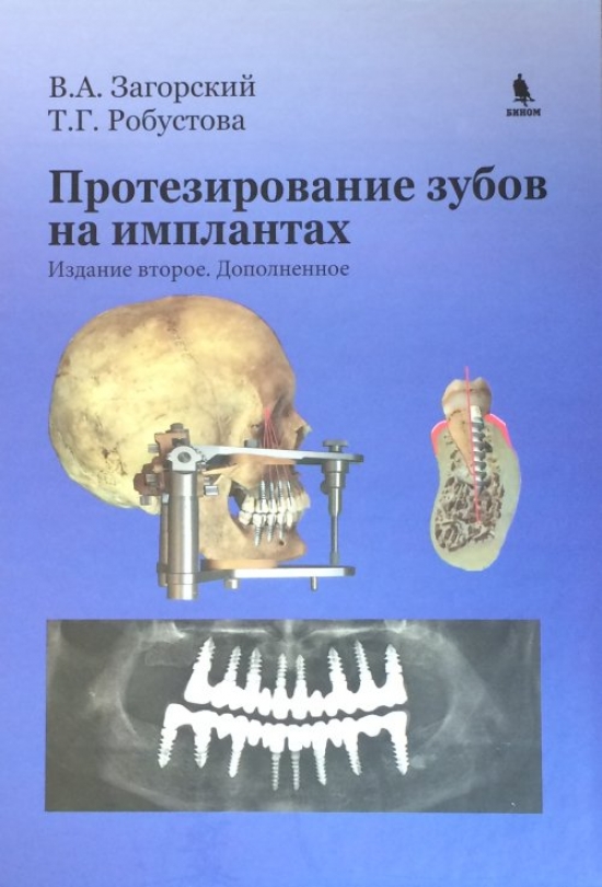 Робустова Т.Г., Загорский В.А. Протезирование зубов на имплантатах 