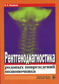 Михайлов М.К. - Рентгенодиагностика родовых повреждений позвоночника 
